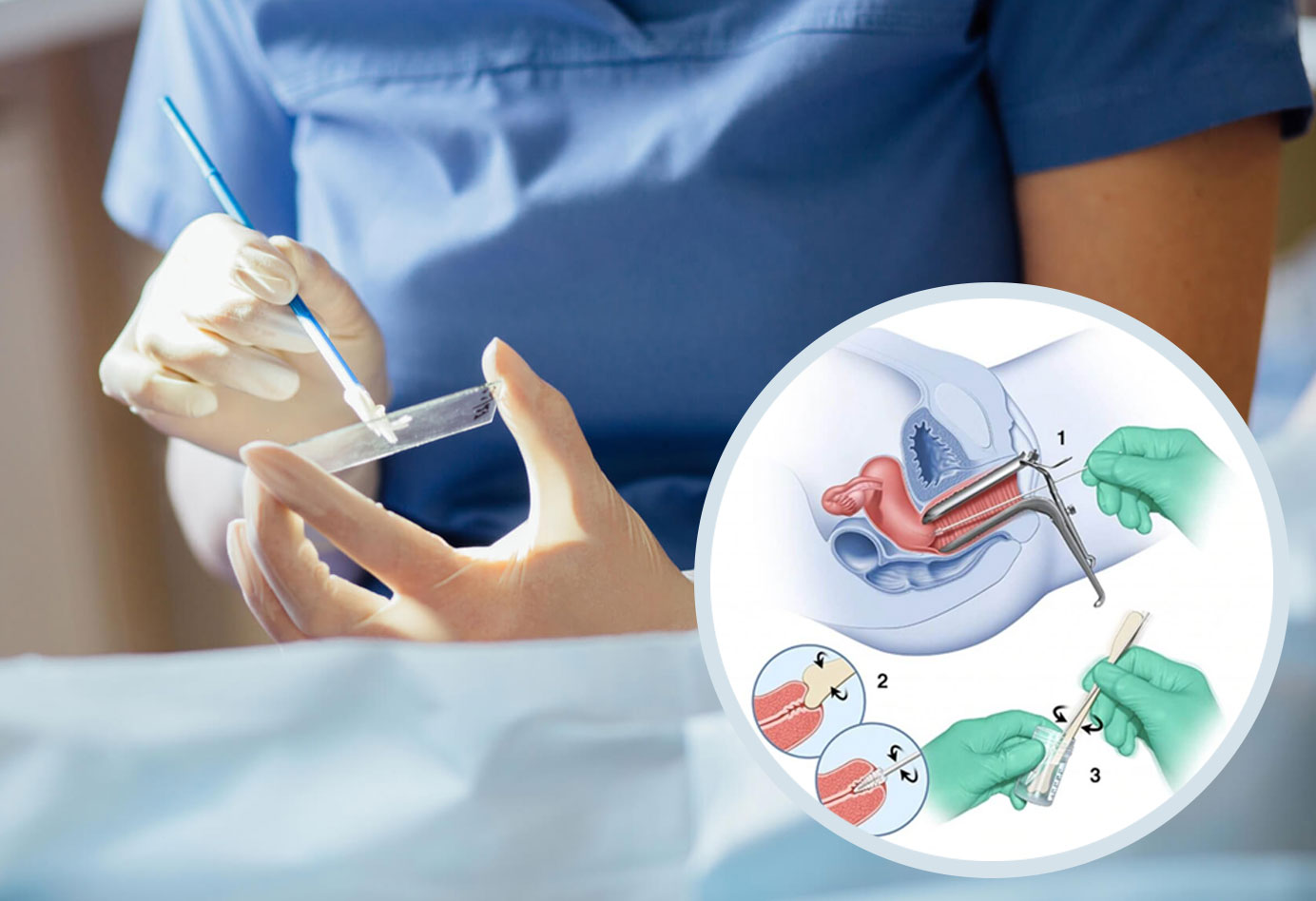 ASCUS Nedir: Atipik Servikal Hücre Değişikliklerinin Anlamı ve Yönetimi